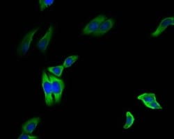 Invitrogen HSP90 beta Recombinant Rabbit Monoclonal Antibody (7G7) 100