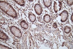 Invitrogen HSP90 beta Recombinant Rabbit Monoclonal Antibody (7G7) 100