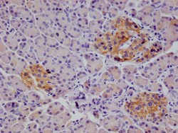 Invitrogen CD166 Recombinant Rabbit Monoclonal Antibody (21B9) 100 &mu;L;