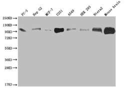 Invitrogen CD166 Recombinant Rabbit Monoclonal Antibody (21B9) 100 &mu;L;