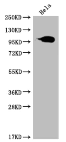 Invitrogen Aconitase 1 Recombinant Rabbit Monoclonal Antibody (22C10) 100