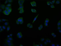 Invitrogen USP14 Recombinant Rabbit Monoclonal Antibody (28C4) 100 &mu;L;