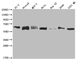 Invitrogen USP14 Recombinant Rabbit Monoclonal Antibody (28C4) 100 &mu;L;