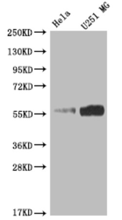 Invitrogen NUF2 Recombinant Rabbit Monoclonal Antibody (8B7) 100 &mu;L;