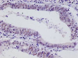 Invitrogen HIF1AN Recombinant Rabbit Monoclonal Antibody (12F11) 100 &mu;L;