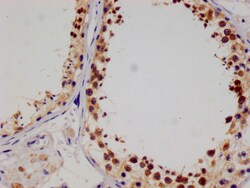 Invitrogen SENP1 Recombinant Rabbit Monoclonal Antibody (25H2) 100 &mu;L;