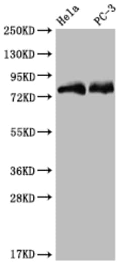 Invitrogen SENP1 Recombinant Rabbit Monoclonal Antibody (25H2) 100 &mu;L;