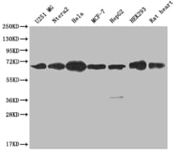 Invitrogen CBX2 Recombinant Rabbit Monoclonal Antibody (24A2) 100 &mu;L;