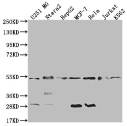 Invitrogen HDJ2 Recombinant Rabbit Monoclonal Antibody (23C6) 100 &mu;L;