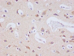JNK3 Recombinant Rabbit Monoclonal Antibody (29E10):Antibodies, Recombinant