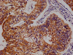Invitrogen FADS1 Recombinant Rabbit Monoclonal Antibody (7A10) 100 &mu;L;