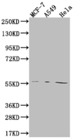 Invitrogen FADS1 Recombinant Rabbit Monoclonal Antibody (7A10) 100 &mu;L;