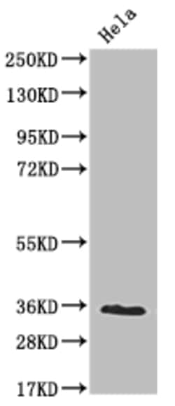 Invitrogen NUDT5 Recombinant Rabbit Monoclonal Antibody (10D2) 100 &mu;L;