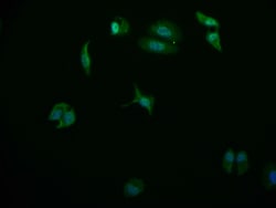 Invitrogen USP24 Recombinant Rabbit Monoclonal Antibody (11E3) 100 &mu;L;