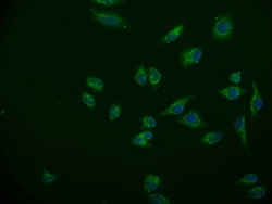 Invitrogen ACAA2 Recombinant Rabbit Monoclonal Antibody (12F4) 100 &mu;L;