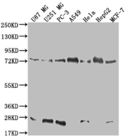 Invitrogen Calpain 2 Recombinant Rabbit Monoclonal Antibody (17E9) 100 &mu;L | Buy Online | Invitrogen&trade; | Fisher Scientific