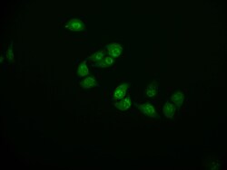 Cystatin B Recombinant Rabbit Monoclonal Antibody (11H4):Antibodies, Recombinant