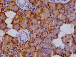Invitrogen CTPS Recombinant Rabbit Monoclonal Antibody (13B6) 100 &mu;L;