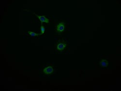 Invitrogen MAS1L Recombinant Rabbit Monoclonal Antibody (15B8) 100 &mu;L;