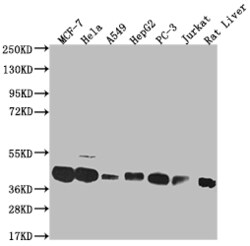 Invitrogen MAS1L Recombinant Rabbit Monoclonal Antibody (15B8) 100 &mu;L;