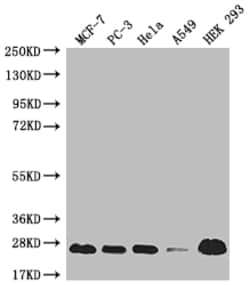Invitrogen MRAS Recombinant Rabbit Monoclonal Antibody (18E11) 100 &mu;L | Buy Online | Invitrogen&trade; | Fisher Scientific