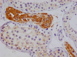 Invitrogen NSDHL Recombinant Rabbit Monoclonal Antibody (20F2) 100 &mu;L;