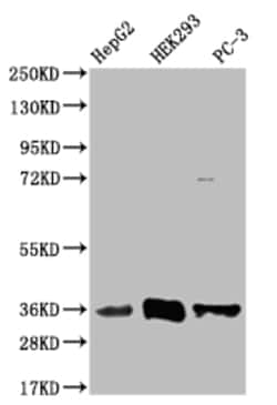Invitrogen NTHL1 Recombinant Rabbit Monoclonal Antibody (22H10) 100 &mu;L;