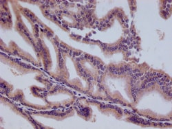 Invitrogen HMGCL Recombinant Rabbit Monoclonal Antibody (22H11) 100 &mu;L;