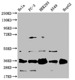 Invitrogen HMGCL Recombinant Rabbit Monoclonal Antibody (22H11) 100 &mu;L;