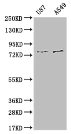 Invitrogen SLC25A12 Recombinant Rabbit Monoclonal Antibody (10B12) 100