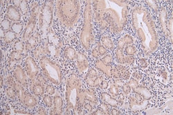 Invitrogen H3K9me1 Recombinant Rabbit Monoclonal Antibody (13E1) 100 &mu;L;