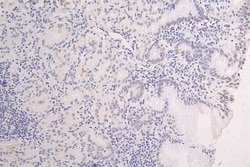 Invitrogen H3K27M Recombinant Rabbit Monoclonal Antibody (35C11) 100 &mu;L;