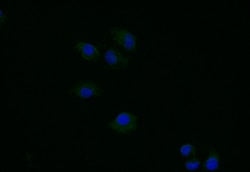 Invitrogen TK1 Recombinant Rabbit Monoclonal Antibody (6F6) 100 &mu;L;