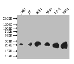 Invitrogen TK1 Recombinant Rabbit Monoclonal Antibody (6F6) 100 &mu;L;
