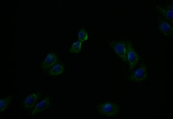 Invitrogen ATP7B Recombinant Rabbit Monoclonal Antibody (36D12) 100 &mu;L;
