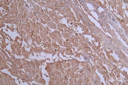 Invitrogen GLUT2 Recombinant Rabbit Monoclonal Antibody (37E1) 100 &mu;L;
