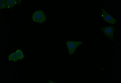 Invitrogen Ferritin Heavy Chain Recombinant Rabbit Monoclonal Antibody
