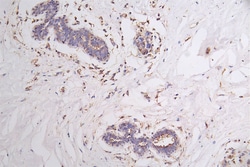 Invitrogen VEGF Receptor 1 Recombinant Rabbit Monoclonal Antibody (40H4)