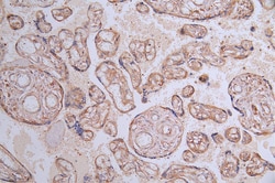 Invitrogen VEGF Receptor 1 Recombinant Rabbit Monoclonal Antibody (40H4)
