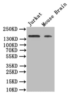 Invitrogen VEGF Receptor 1 Recombinant Rabbit Monoclonal Antibody (40H4)