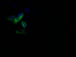 Invitrogen Pannexin 1 Recombinant Rabbit Monoclonal Antibody (28G5) 100