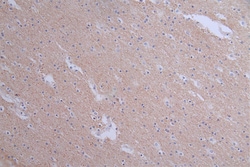 Invitrogen Pannexin 1 Recombinant Rabbit Monoclonal Antibody (28G5) 100