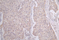 Invitrogen Pannexin 1 Recombinant Rabbit Monoclonal Antibody (28G5) 100