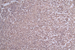 Invitrogen Ferritin Light Chain Recombinant Rabbit Monoclonal Antibody