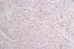 Invitrogen Cytokeratin 10 Recombinant Rabbit Monoclonal Antibody (18B6)