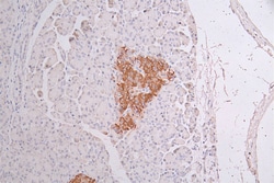 Invitrogen Cytokeratin 10 Recombinant Rabbit Monoclonal Antibody (18B6)