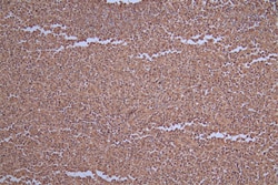 Invitrogen Carbonic Anhydrase I Recombinant Rabbit Monoclonal Antibody