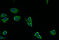 Invitrogen PRKAR2A Recombinant Rabbit Monoclonal Antibody (15G8) 100 &mu;L;