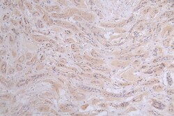 Invitrogen PRKAR2A Recombinant Rabbit Monoclonal Antibody (15G8) 100 &mu;L;