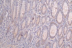 Invitrogen PRKAR2A Recombinant Rabbit Monoclonal Antibody (15G8) 100 &mu;L;